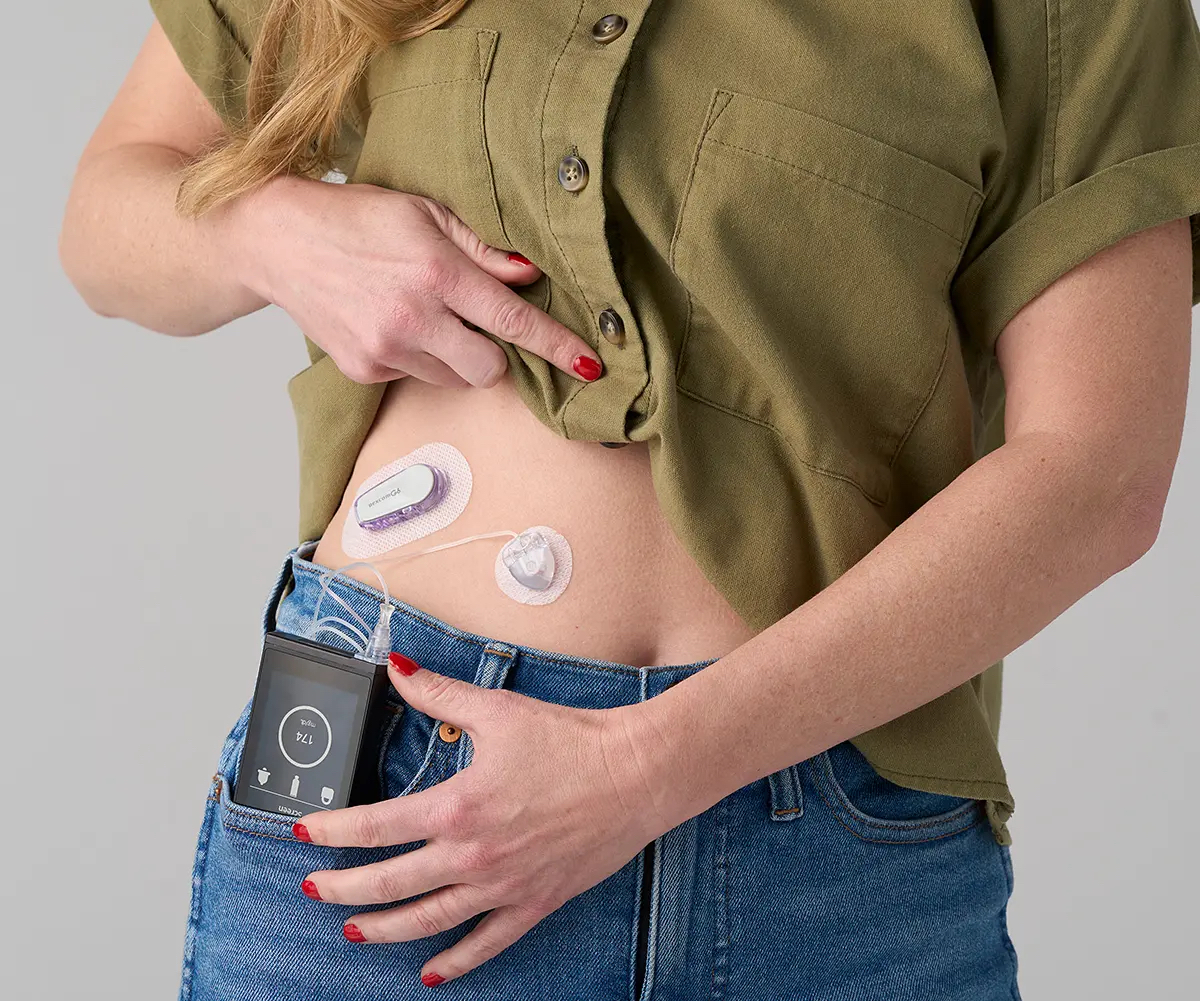 iLet Bionic Pancreas