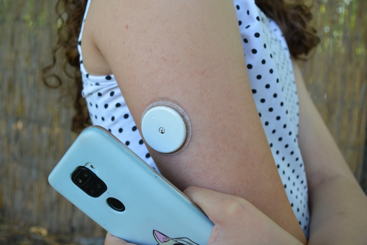 child wearing CGM