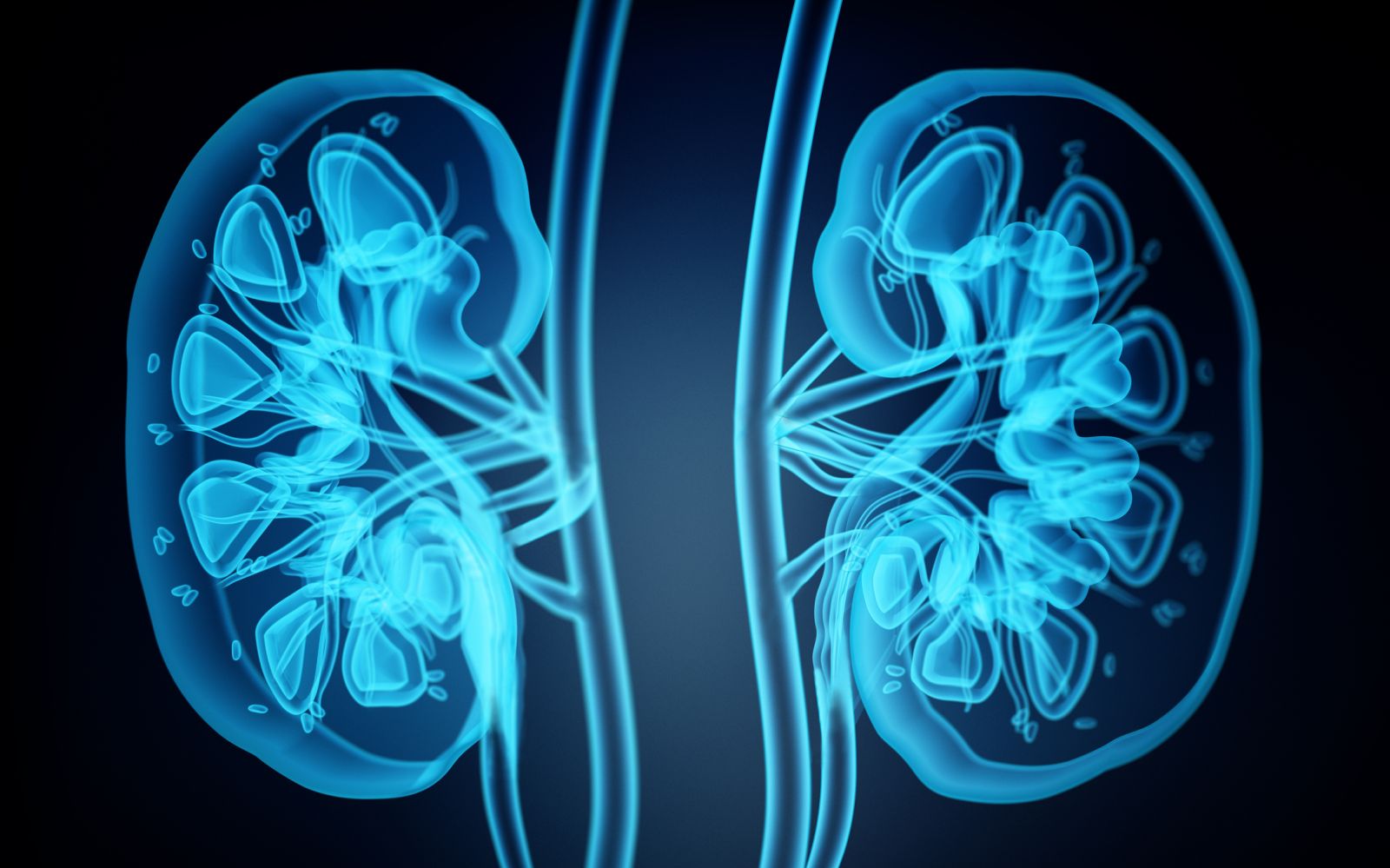 Kidney x-ray