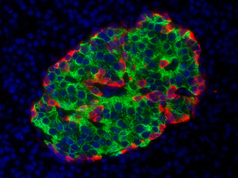 Microscopic view of islet cells in the pancreas