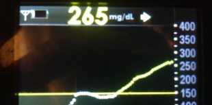 CGM reading