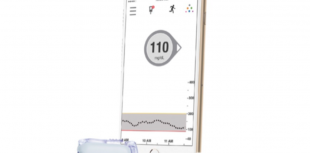 Dexcom G5 Mobile CGM System