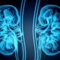 Kidney x-ray