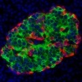 Microscopic view of islet cells in the pancreas